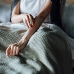 Woman scratching her arm in bed.