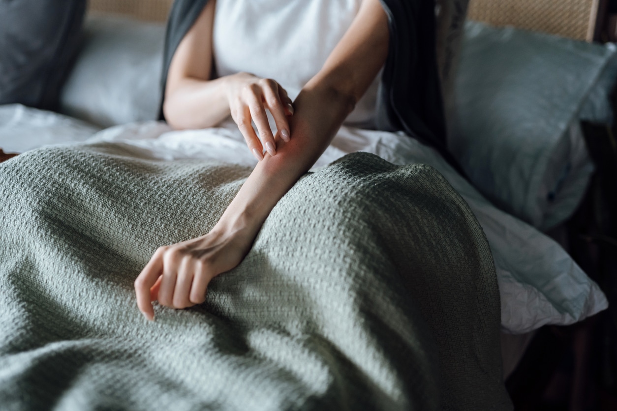 Woman scratching her arm in bed.